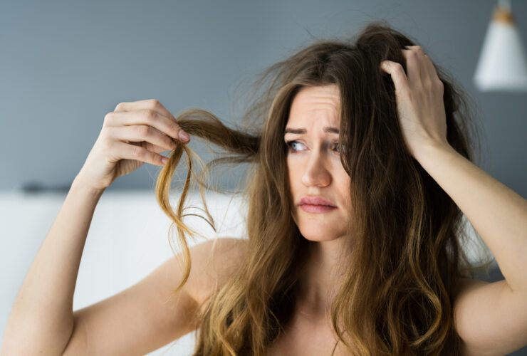 Woman going through menopause with hair loss wondering if menopause causes hair loss.